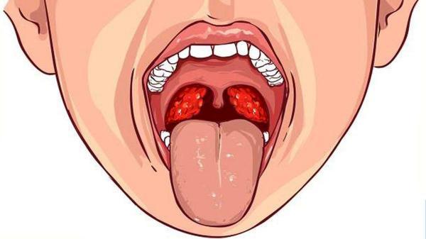 سرطان دهان چه نشانه هایی دارد؟