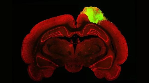 ترمیم مغز آسیب دیده موش با سلول های آزمایشگاهی مغز انسان